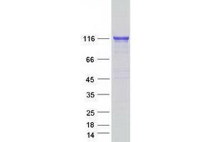 TXNDC11 Protein (Myc-DYKDDDDK Tag)