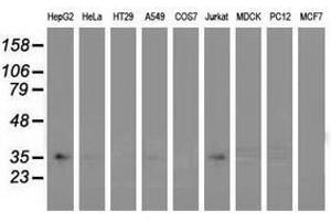 Image no. 2 for anti-Glyoxylate Reductase/hydroxypyruvate Reductase (GRHPR) antibody (ABIN1498519) (GRHPR anticorps)
