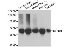 Western blot analysis of extracts of various cell lines, using ETFDH antibody. (ETFDH anticorps  (AA 318-617))