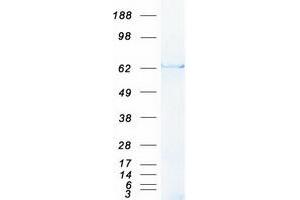Validation with Western Blot