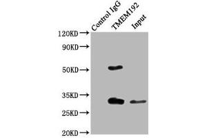 Immunoprecipitating TMEM192 in Jurkat whole cell lysate Lane 1: Rabbit control IgG (1 μg) instead of ABIN7173123 in Jurkat whole cell lysate. (TMEM192 anticorps  (AA 193-271))