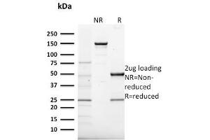 SDS-PAGE Analysis Purified Frataxin Mouse Monoclonal Antibody (FXN/2124).