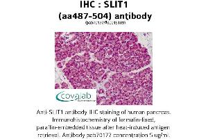 Image no. 1 for anti-Slit Homolog 1 (SLIT1) (AA 487-504) antibody (ABIN1739431)