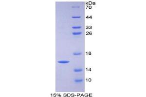 SDS-PAGE analysis of Human FABP3 Protein.