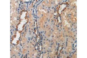 Used in DAB staining on fromalin fixed paraffin- embedded kidney tissue (IGFBP6 anticorps  (AA 31-240))