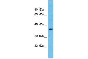 Host:  Rabbit  Target Name:  ISL1  Sample Type:  Breast Tumor lysates  Antibody Dilution:  1. (ISL1 anticorps  (C-Term))