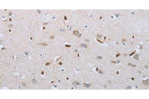 Immunohistochemistry of paraffin-embedded Human brain tissue using FGF1 Polyclonal Antibody at dilution 1:50 (FGF1 anticorps)