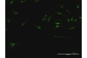 Immunofluorescence of purified MaxPab antibody to UTP18 on HeLa cell. (UTP18 anticorps  (AA 1-521))