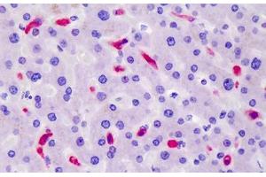 Human Liver: Formalin-Fixed, Paraffin-Embedded (FFPE) (CD163 anticorps)