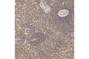 IHC analysis of TST using anti-TST antibody (ABIN7599105). (TST anticorps  (AA 1-220))