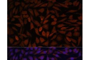 Immunofluorescence analysis of L929 cells using KLHL8 Polyclonal Antibody at dilution of 1:100. (KLHL8 anticorps)