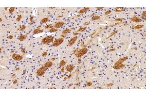 Detection of Flt3L in Mouse Cerebrum Tissue using Polyclonal Antibody to FMS Like Tyrosine Kinase 3 Ligand (Flt3L) (FLT3LG anticorps  (AA 27-189))
