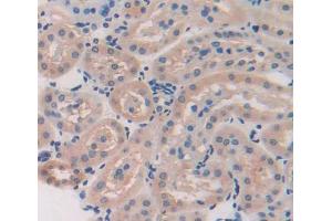 Used in DAB staining on fromalin fixed paraffin- embedded kidney tissue