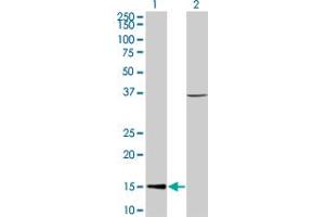 Western Blot analysis of CHRAC1 expression in transfected 293T cell line by CHRAC1 monoclonal antibody (M05), clone 4B8.