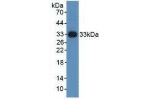 Detection of Recombinant HIF1a, Mouse using Polyclonal Antibody to Hypoxia Inducible Factor 1 Alpha (HIF1a)