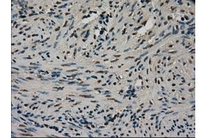 Immunohistochemical staining of paraffin-embedded Ovary tissue using anti-CTAG1Bmouse monoclonal antibody. (CTAG1B anticorps)