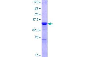 Glia Maturation Factor, gamma (GMFG) (AA 1-142) protein (GST tag)
