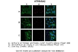 Application: IHC/Immunofluorescence Species+tissue/cell type:A. (ATP6V0A2 anticorps  (N-Term))