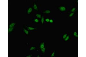 Immunofluorescent analysis of Hela cells using ABIN7152677 at dilution of 1:100 and Alexa Fluor 488-congugated AffiniPure Goat Anti-Rabbit IgG(H+L)