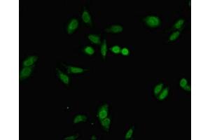 Immunofluorescent analysis of Hela cells using ABIN7152677 at dilution of 1:100 and Alexa Fluor 488-congugated AffiniPure Goat Anti-Rabbit IgG(H+L) (FERD3L anticorps  (AA 1-167))
