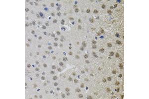 Immunohistochemistry of paraffin-embedded mouse brain using MKL1 antibody. (MKL1 anticorps)