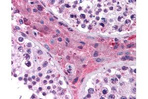 Anti-NR1H4 antibody IHC of human testis.