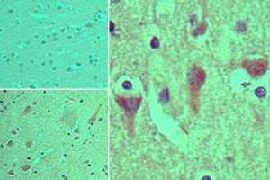 Image no. 1 for anti-ArfGAP with SH3 Domain, Ankyrin Repeat and PH Domain 3 (ASAP3) (AA 693-710) antibody (ABIN960088)