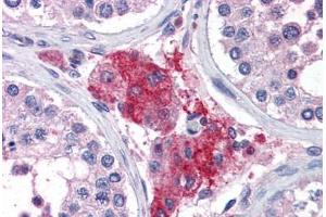Human Testis (formalin-fixed, paraffin-embedded) stained with ACYP1 antibody ABIN351487 at 3. (ACYP1 anticorps  (AA 72-85))