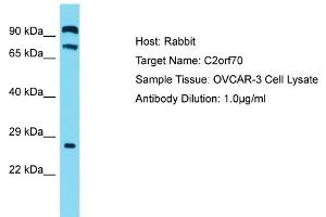 Host: Rabbit Target Name: C2ORF70 Sample Tissue: Human OVCAR-3 Whole Cell Antibody Dilution: 1ug/ml (C2ORF70 anticorps  (C-Term))