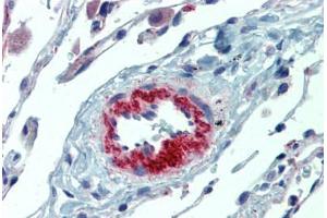 Lung, vasculature, Human: Formalin-Fixed, Paraffin-Embedded (FFPE) (IL23A anticorps)