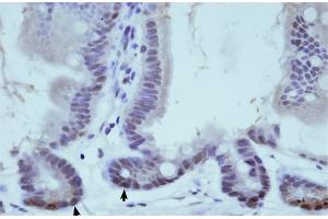 Rabbit Anti-THOC1 Antibody  arp40578 Paraffin Embedded Tissue: Murine Small Intestine Cellular Data: Crypt-Villus Axis Antibody Concentration: 0. (THOC1 anticorps  (C-Term))