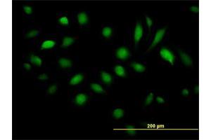 Immunofluorescence of purified MaxPab antibody to BAG5 on HeLa cell.
