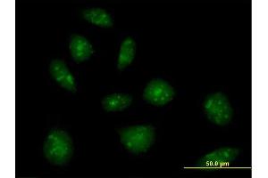 Immunofluorescence of purified MaxPab rabbit antibody to IL16 on HeLa cell. (IL16 anticorps  (AA 1-454))