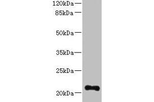 Western blot All lanes: TTC9C antibody at 12 μg/mL + THP-1 whole cell lysate Secondary Goat polyclonal to rabbit IgG at 1/10000 dilution Predicted band size: 21, 25 kDa Observed band size: 21 kDa (TTC9C anticorps  (AA 1-171))