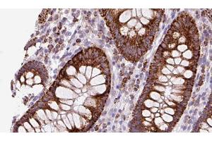 ABIN6272883 at 1/100 staining Mouse colon tissue by IHC-P. (TMEM67 anticorps  (Internal Region))