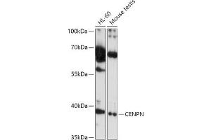 Western blot analysis of extracts of various cell lines, using CENPN antibody (ABIN7266276) at 1:1000 dilution.