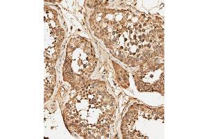 (ABIN392786 and ABIN2842224) staining PFKFB4 in human testis tissue sections by Immunohistochemistry (IHC-P - paraformaldehyde-fixed, paraffin-embedded sections). (PFKFB4 anticorps  (AA 266-296))