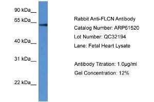 Western Blotting (WB) image for anti-Folliculin (FLCN) (N-Term) antibody (ABIN2788829) (FLCN anticorps  (N-Term))