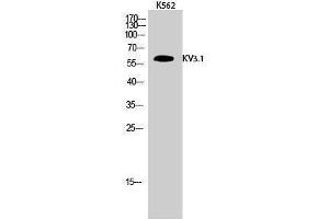 Western Blotting (WB) image for anti-Potassium Voltage-Gated Channel, Shaw-Related Subfamily, Member 1 (KCNC1) (Internal Region) antibody (ABIN3185333) (KCNC1 anticorps  (Internal Region))