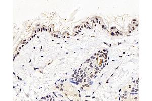 Immunohistochemistry analysis of paraffin-embedded mouse skin using MGMT Polyclonal Antibody at dilution of 1:300.