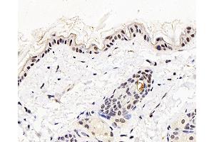 Immunohistochemistry analysis of paraffin-embedded mouse skin using MGMT Polyclonal Antibody at dilution of 1:300. (MGMT anticorps)