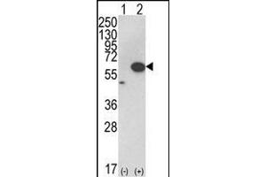 Western blot analysis of AKT1 (arrow) using rabbit polyclonal hAKT1- (ABIN652283 and ABIN2841190). (AKT1 anticorps  (C-Term))