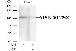 Western blot analysis of extracts from Hela cells, treated with IL-4 or calf intestinal phosphatase (CIP), using STAT6 (Phospho-Thr645) Antibody.