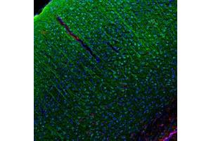 Image no. 1 for anti-Chemokine (C-C Motif) Ligand 5 (CCL5) antibody (ABIN465616) (CCL5 anticorps)