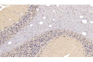 Detection of SIGLEC10 in Human Cerebellum Tissue using Monoclonal Antibody to Sialic Acid Binding Ig Like Lectin 10 (SIGLEC10)