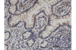 Immunoperoxidase of monoclonal antibody to KIF1C on formalin-fixed paraffin-embedded human small Intestine.