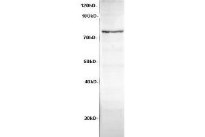 Western Blot analysis of HeLa cells using Cadherin-8 Polyclonal Antibody at dilution of 1:600 (Cadherin 8 anticorps)
