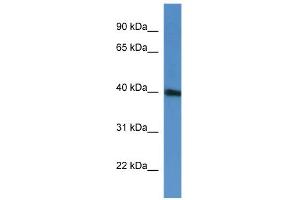 WB Suggested Anti-PRPF38A Antibody Titration: 0.