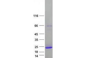 Validation with Western Blot