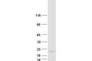 Validation with Western Blot